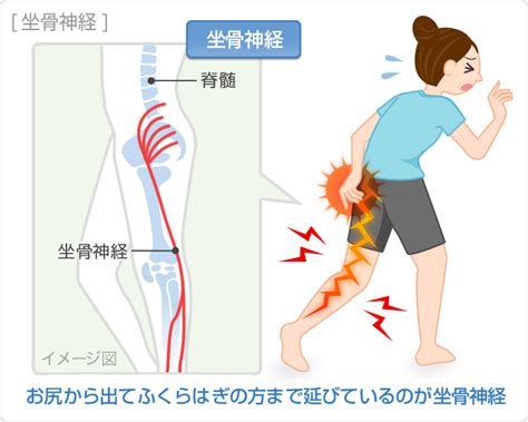 勃起 いたい|陰茎痛の原因と対処法：一般的な症状と医師への相談。